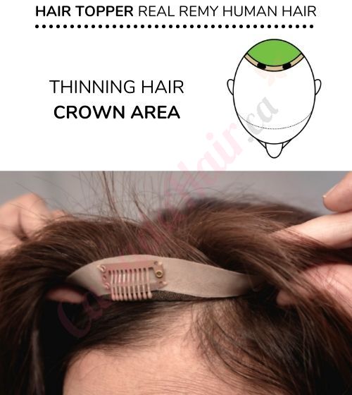 Hair pieces for women's thinning hair toronto online