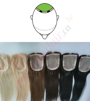 Hair Topper for Thinning Hair Crown (Size: 5 inch x 4 inch) Remy Human Hair 