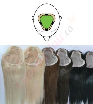 Hair Topper For Thinning Hair Part Large Coverage (Size: 3