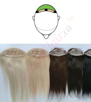 Hair Topper For Thinning Hair Full Crown (Size: 6.5 inch x 2.25 inch) Remy Human Hair 