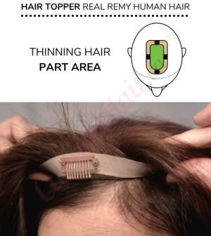 Hair Topper For Thinning Hair Part (Size: 2.75