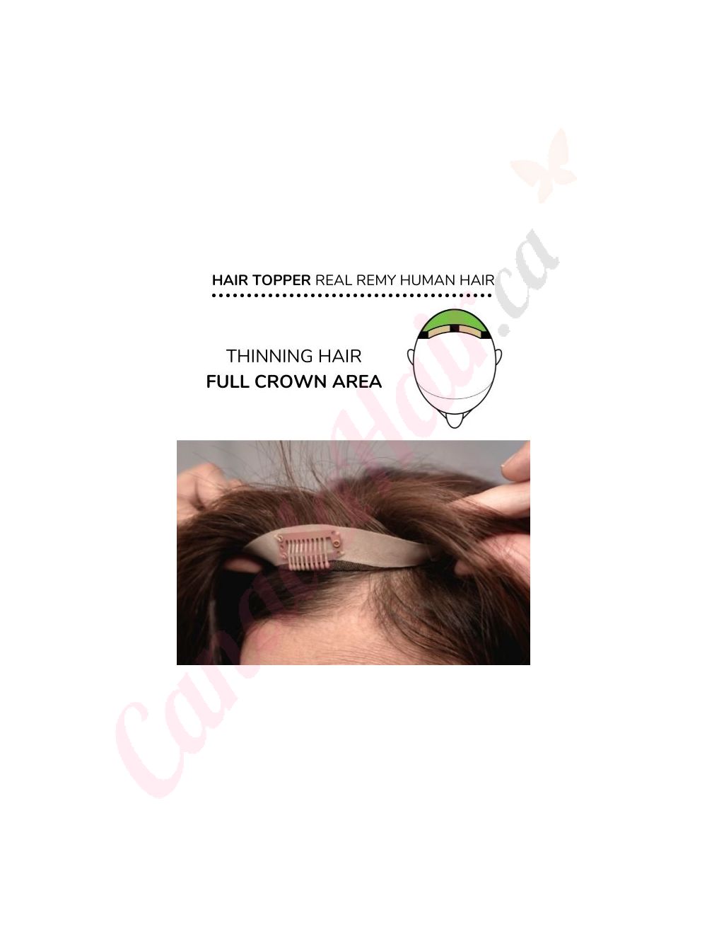 Hair piece for crown thinning hair store