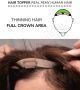Hair Topper For Thinning Hair Full Crown (Size: 6.5 inch x 2.25 inch) Remy Human Hair 
