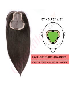 Black / Brown #1b Hair Topper For Thinning Hair Part Large Coverage (Size: 3 inch - 5.75 inch x 5 inch) Remy Human Hair 