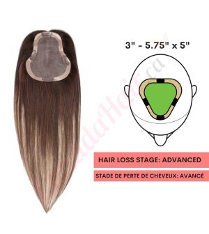 Dark Brown & Blonde Balayage Hair Topper For Thinning Hair Part Large Coverage (Size: 3 inch - 5.75 inch x 5 inch) Remy Human Hair 