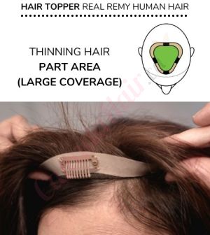 Topper for Hair Part hair topper for thinning hair part Remy Hair Topper for Hair Part