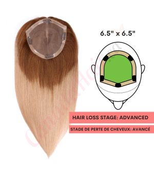 Ombre Blonde Hair Topper for Full Coverage (Size: 6.5 inch x 6.5 inch) Remy Human Hair 