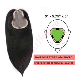 Jet Black #1 Hair Topper For Thinning Hair Part Large Coverage (Size: 3 inch - 5.75 inch x 5 inch) Remy Human Hair 