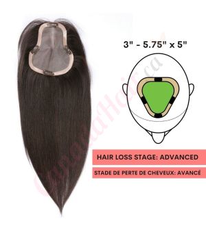 Black / Brown #1b Hair Topper For Thinning Hair Part Large Coverage (Size: 3 inch - 5.75 inch x 5 inch) Remy Human Hair 