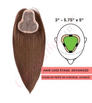 Dark Brown #2 Hair Topper For Thinning Hair Part Large Coverage (Size: 3 inch - 5.75 inch x 5 inch) Remy Human Hair 