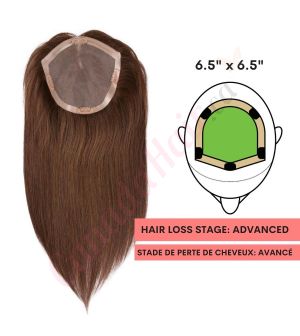 Dark Brown #2 Hair Topper for Full Coverage (Size: 6.5 inch x 6.5 inch) Remy Human Hair
