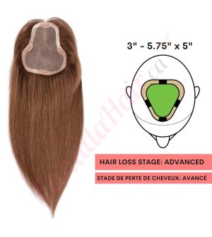 Chocolate Brown #4 Hair Topper For Thinning Hair Part Large Coverage (Size: 3 inch - 5.75 inch x 5 inch) Remy Human Hair 