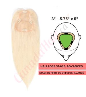 Platinum Blonde  Hair Topper For Thinning Hair Part Large Coverage (Size: 3 inch - 5.75 inch x 5 inch) Remy Human Hair 