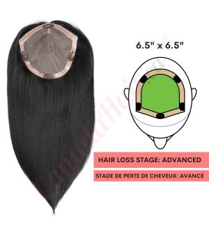 Jet Black #1 Hair Topper for Full Coverage (Size: 6.5 inch x 6.5 inch) Remy Human Hair 