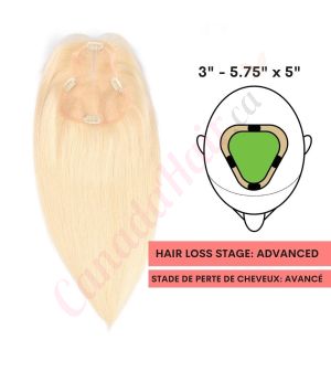 Bleach Blonde #613 Hair Topper For Thinning Hair Part Large Coverage (Size: 3 inch - 5.75 inch x 5 inch) Remy Human Hair 
