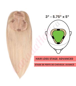 Sandy Blonde Hair Topper For Thinning Hair Part Large Coverage (Size: 3 inch - 5.75 inch x 5 inch) Remy Human Hair 